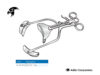Miles Retractor